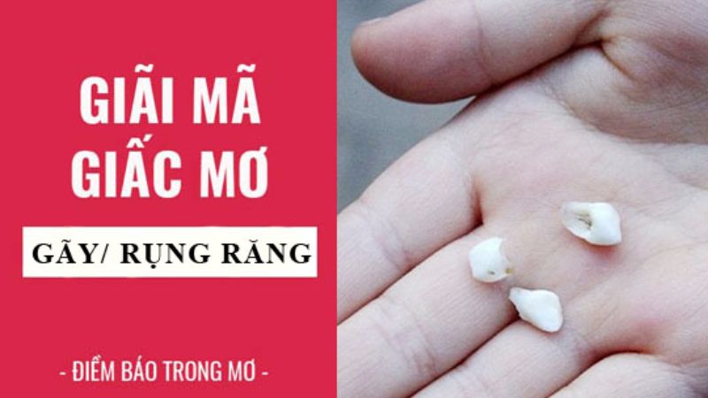 Phân Tích về việc Nằm Mơ Thấy Rụng Răng